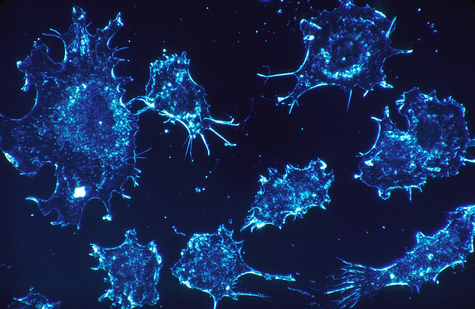 Lee más sobre el artículo Se descubre el mecanismo por el cual las células de un tumor canceroso provocan metástasis