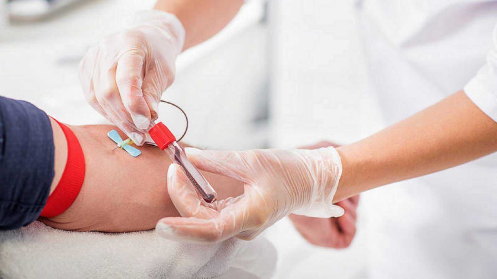 Read more about the article Un nuevo análisis de sangre es capaz de detectar 20 tipos de cáncer con precisión