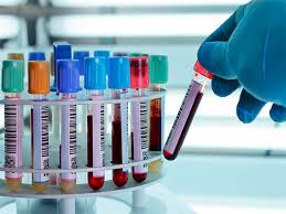 Lee más sobre el artículo La Rioja | El CIBIR logra identificar biomarcadores para el diagnóstico precoz del cáncer de páncreas