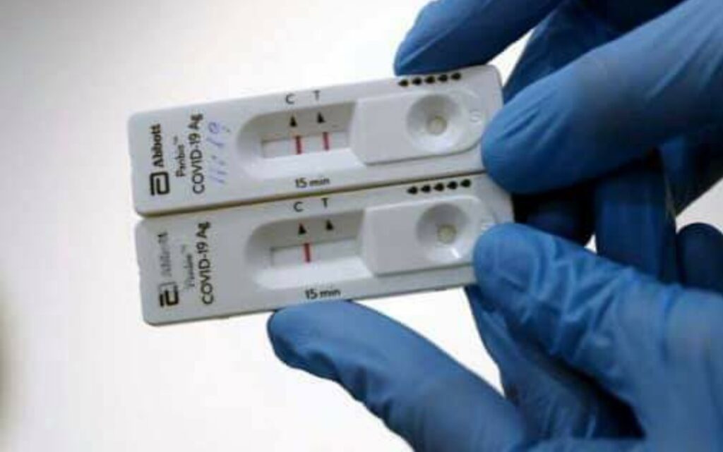 Lee más sobre el artículo Los test de antígenos no son eficaces para controlar el avance del coronavirus en esta segunda ola