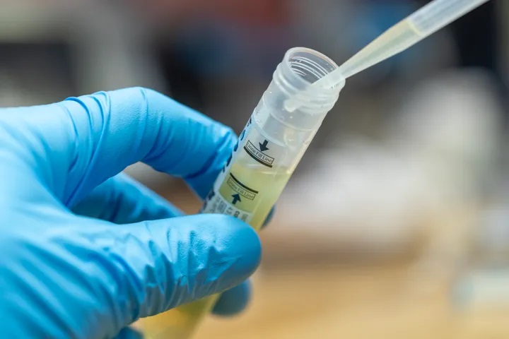 Lee más sobre el artículo Cuál es la diferencia entre PCR, test de antígenos y test serológico